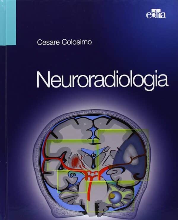 Copertina di CESARE COLOSIMO NEURORADIOLOGIA