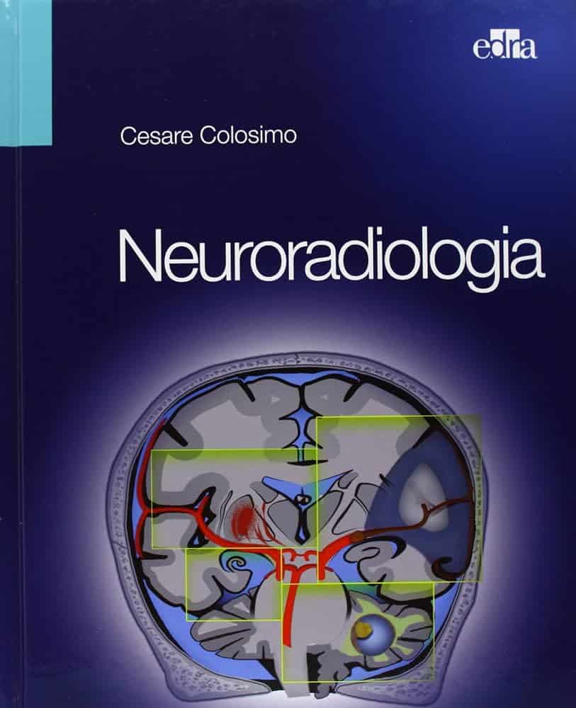 Copertina di CESARE COLOSIMO NEURORADIOLOGIA