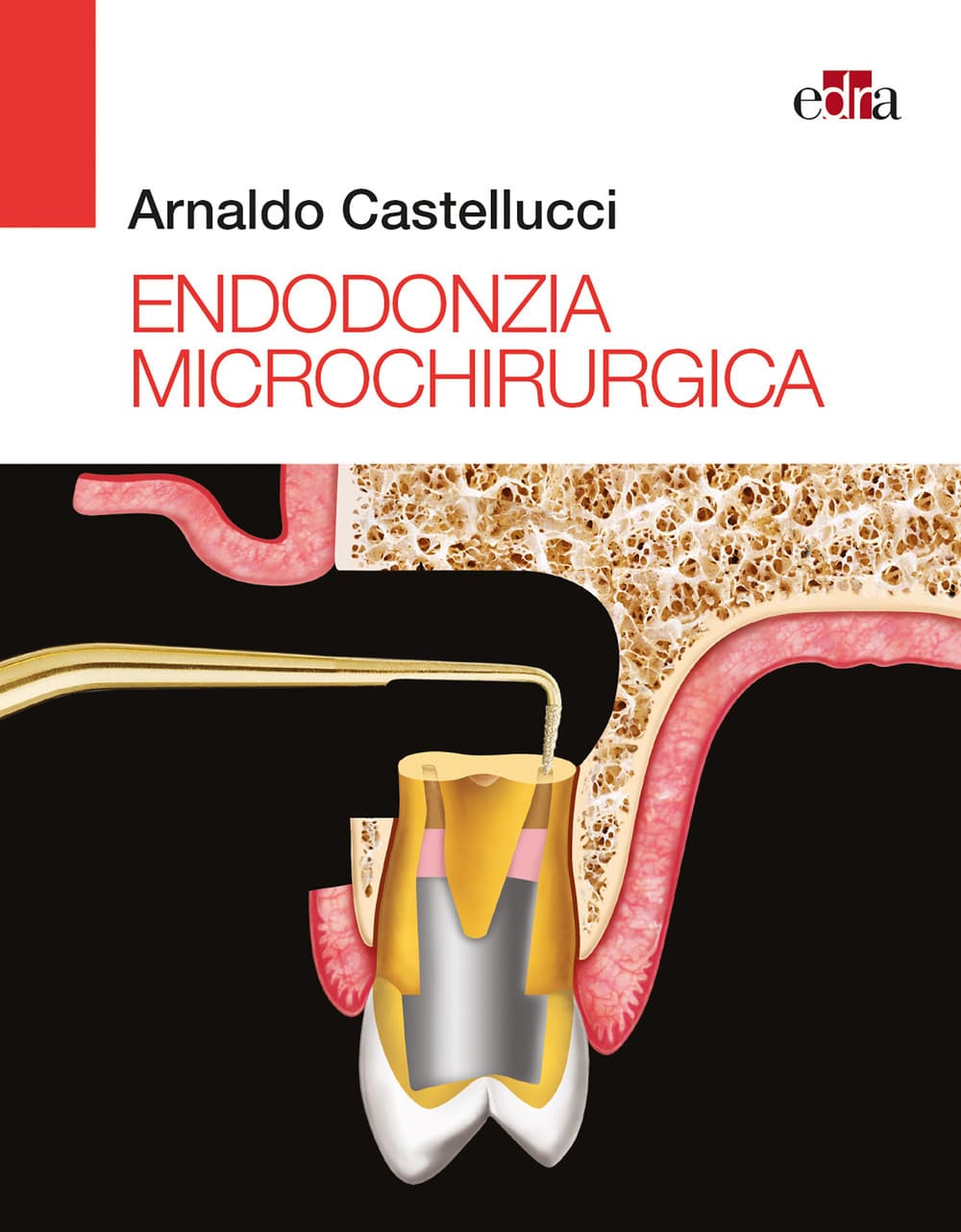 Copertina di Arnaldo Castellucci, Endodonzia microchirurgica
