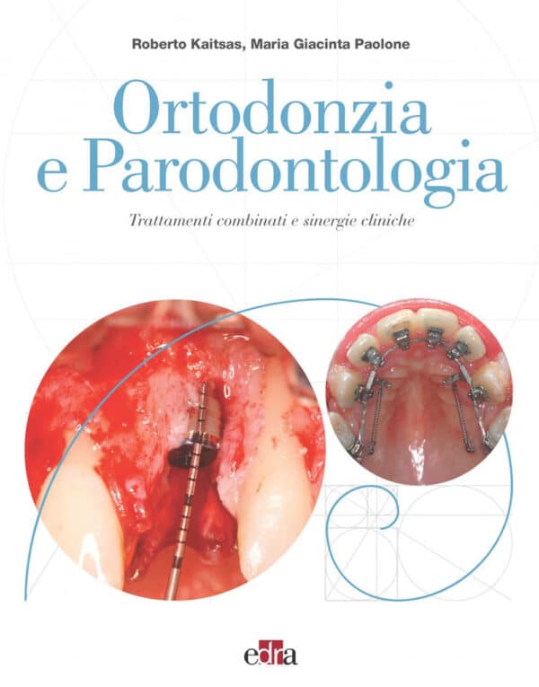 Copertina di Roberto Kaitsas Ortodonzia e Parodontologia – Trattamenti combinati e sinergie cliniche