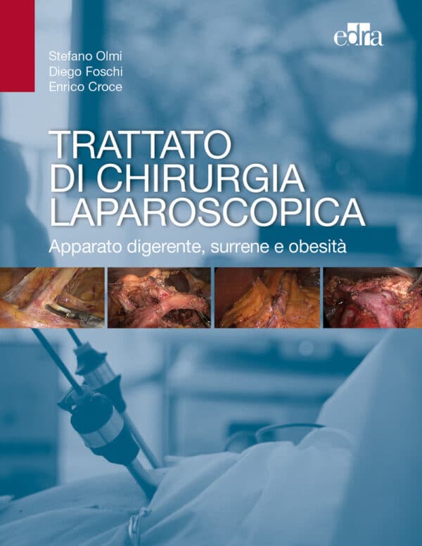 Copertina di STEFANO OLMI TRATTATO DI CHIRURGIA LAPAROSCOPICA